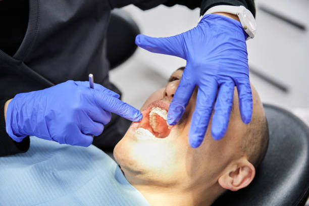 Best Emergency Wisdom Tooth Extraction in Fanning Springs, FL