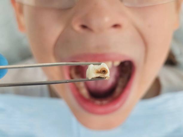Best Broken or Chipped Tooth Repair in Fanning Springs, FL